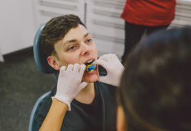 Before - Taking the first step towards your new smile